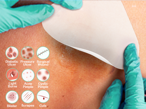Ourmed Advanced Wound Care Hydrocolloid Bandages Dressing